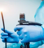 Best Endoscopy Centre in Kudlu Gate for Safe and Accurate Diagnosis